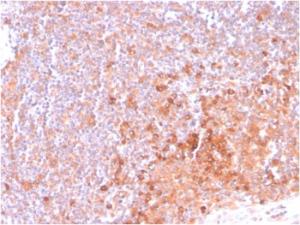 Immunohistochemical analysis of formalin-fixed, paraffin-embedded human tonsil using Anti-CD134 Antibody [OX40/3108]