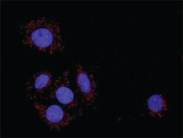 Anti-PDGFRB + CRKL Antibody Pair