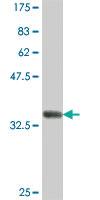 Anti-HERPUD1 Mouse Polyclonal Antibody