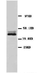 Anti-NSE Rabbit Polyclonal Antibody