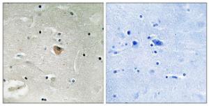 Immunohistochemical analysis of paraffin-embedded human brain using Anti-KIF13B Antibody. The right hand panel represents a negative control, where the antibody was pre-incubated with the immunising peptide