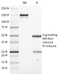 SDS-PAGE analysis of Anti-Mucin 5AC Antibody [58M1] under non-reduced and reduced conditions; showing intact IgG and intact heavy and light chains, respectively. SDS-PAGE analysis confirms the integrity and purity of the Antibody