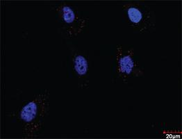 Anti-PDGFRB + CRKL Antibody Pair