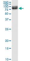 Anti-PLXDC1 Rabbit Polyclonal Antibody