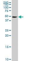 Anti-ZNF598 Mouse Polyclonal Antibody