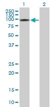 Anti-ITPKC Mouse Polyclonal Antibody