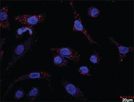 Anti-PDGFRB + CRKL Antibody Pair