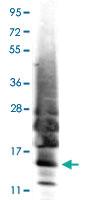 Anti-IL13 Rabbit Polyclonal Antibody