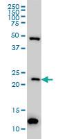 Anti-BAG2 Mouse Monoclonal Antibody [clone: 6E12]