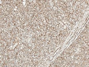 Immunohistochemistry analysis of human kidney, fixed in formalin and paraffin-embedded. The Primary Antibody used was Anti-Wnt4 Antibody (A304875) at 1:50 for 30 minutes at room temperature. Counterstain: Hematoxylin. Magnification: 10X. HRP-DAB Detection.