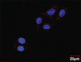 Anti-PDGFRB + CRKL Antibody Pair