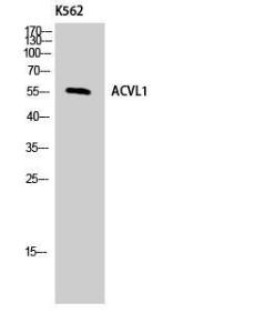 Anti-ACVRL1 Rabbit Polyclonal Antibody