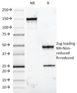 SDS-PAGE analysis of Anti-Mucin 5AC Antibody [9-13M1] under non-reduced and reduced conditions; showing intact IgG and intact heavy and light chains, respectively. SDS-PAGE analysis confirms the integrity and purity of the antibody