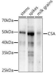 Anti-CSA antibody