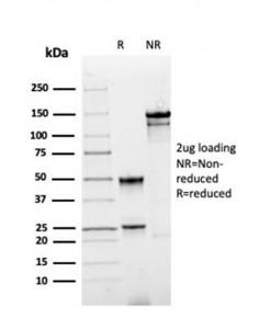 SDS-PAGE analysis of Anti-Annexin A1 Antibody [rANXA1/4310] under non-reduced and reduced conditions; showing intact IgG and intact heavy and light chains, respectively. SDS-PAGE analysis confirms the integrity and purity of the antibody.