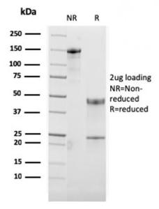 SDS-PAGE analysis of Anti-CD134 Antibody [OX40/3108] under non-reduced and reduced conditions; showing intact IgG and intact heavy and light chains, respectively. SDS-PAGE analysis confirms the integrity and purity of the antibody