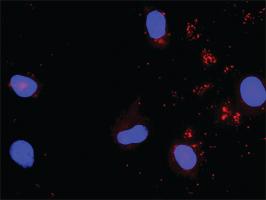 Anti-STAT5A + SHC1 Antibody Pair