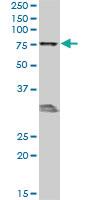 Anti-MBD1 Mouse Monoclonal Antibody [clone: 2H3]