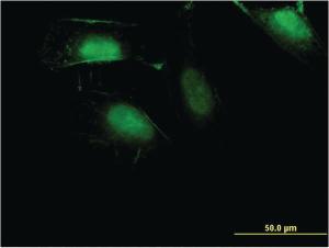 Anti-ZNF598 Mouse Monoclonal Antibody [clone: 1E2]