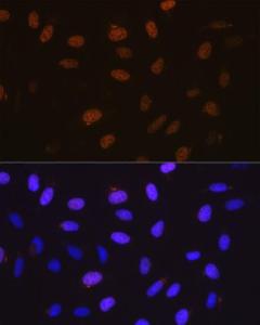 Immunofluorescence analysis of U-2 OS cells using Anti-Cyclin A2 Antibody [ARC0359] (A308964) at a dilution of 1:100 (40X lens). DAPI was used to stain the cell nuclei (blue)