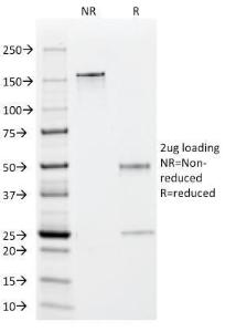 SDS-PAGE analysis of Anti-EBV Early Antigens Antibody [1108-1] under non-reduced and reduced conditions; showing intact IgG and intact heavy and light chains, respectively. SDS-PAGE analysis confirms the integrity and purity of the antibody