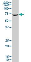 Anti-MBD1 Mouse Monoclonal Antibody [clone: 2H3]