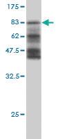 Anti-HERPUD1 Mouse Monoclonal Antibody [clone: 3E10]