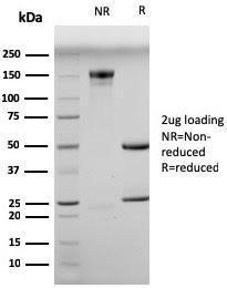 SDS-PAGE analysis of Anti-Myogenin Antibody [MGN185] under non-reduced and reduced conditions; showing intact IgG and intact heavy and light chains, respectively. SDS-PAGE analysis confirms the integrity and purity of the antibody.