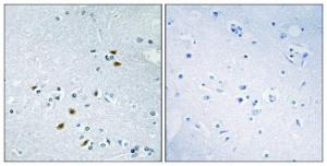 Antibody anti-BRCA2 100 µg