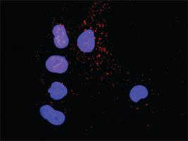 Anti-CRK + SHC1 Antibody Pair