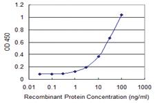 Anti-MBD1 Mouse Monoclonal Antibody [clone: 2H3]