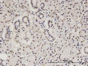 Anti-CBFA2T2 Mouse Monoclonal Antibody [clone: 2C10]