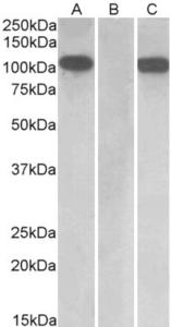 HEK293 lysate (10ug protein in RIPA buffer) overexpressing Human Furin with C-terminal MYC tag probed with EB08896 (1 µg/ml) in Lane A and probed with anti-MYC Tag (1/1000) in lane C. Mock-transfected HEK293 probed with EB08896 (1 µg/ml) in Lane B. Primary