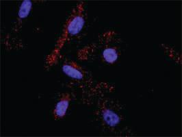 Anti-KIT + PLCG1 Antibody Pair