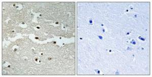 Antibody anti-BRCA2 100 µg