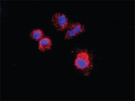 Anti-KIT + PLCG1 Antibody Pair