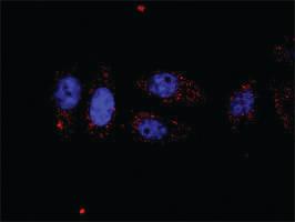 Anti-KIT + PLCG1 Antibody Pair