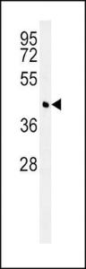 Anti-BCAT1 Rabbit Polyclonal Antibody (APC (Allophycocyanin))