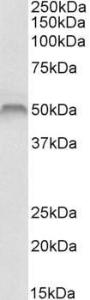 Anti-FSCN1 Antibody (A84470) (1µg/ml) staining of Human Skeletal Muscle lysate (35µg protein in RIPA buffer). Primary incubation was 1 hour. Detected by chemiluminescence.