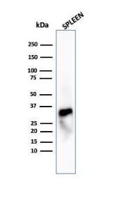 Western blot analysis of human spleen tissue lysate using Anti-Granzyme B Antibody [GZMB/4539R]