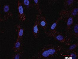 Anti-KIT + PLCG1 Antibody Pair