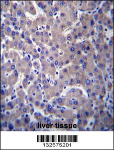 Anti-GPR34 Rabbit Polyclonal Antibody (AP (Alkaline Phosphatase))