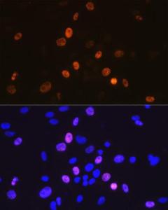 Immunofluorescence analysis of C6 cells using Anti-Cyclin A2 Antibody [ARC0359] (A308964) at a dilution of 1:100 (40X lens). DAPI was used to stain the cell nuclei (blue)