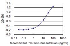 Anti-ZNF598 Mouse Monoclonal Antibody [clone: 1E2]