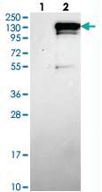 Anti-CCDC146 Rabbit Polyclonal Antibody