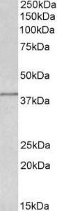 Anti-IDH3G antibody