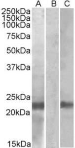 HEK293 lysate (10 µg protein in RIPA buffer) overexpressing Human CST8 (RC210130) with C-terminal MYC tag probed with EB09823 (1 µg/ml) in Lane A and probed with anti-MYC Tag (1/1000) in lane C. Mock-transfected HEK293 probed with EB09823 (1mg/ml) in Lane B