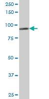 Anti-DDX1 Mouse Monoclonal Antibody [clone: 4F6]