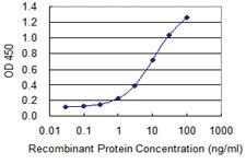 Anti-EML4 Mouse Monoclonal Antibody [clone: 2F2]