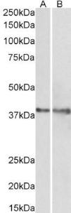 Anti-IDH3G antibody